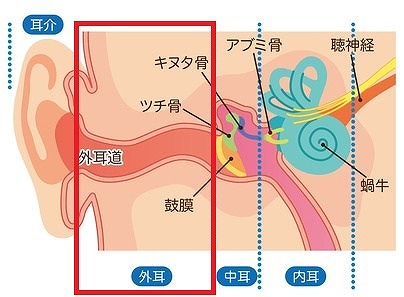 外耳炎